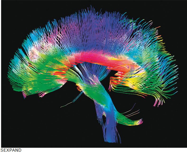 Cryonics-For-life-Technology_Brain-Plasticization