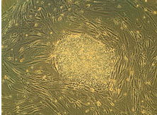 Human stem cells